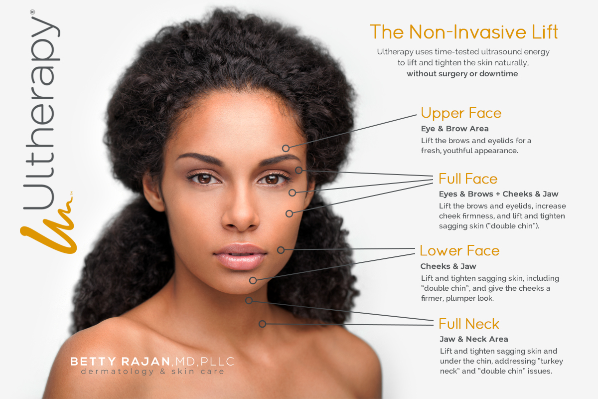 FAQ | Ultherapy | Spa Radiance Medical | San Francisco Med Spa